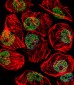 TBP Antibody (Center)